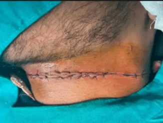 पतंग के धागे से 16 वर्षीय लड़के की मौत, परिजनों का आरोप-‘प्रतिबंधित चीनी मांझे से गई जान’