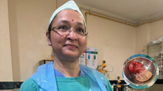 इंदौर में एक महिला के पेट से फुटबॉल के आकार की गांठ निकाली गई