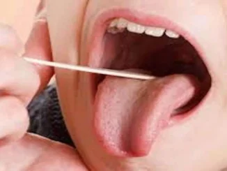 लार से होगी मुंह के कैंसर की पहचान, आईआईटी इंदौर ने विकसित की नयी तकनीक
