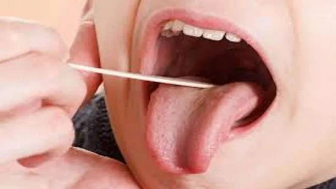 लार से होगी मुंह के कैंसर की पहचान, आईआईटी इंदौर ने विकसित की नयी तकनीक